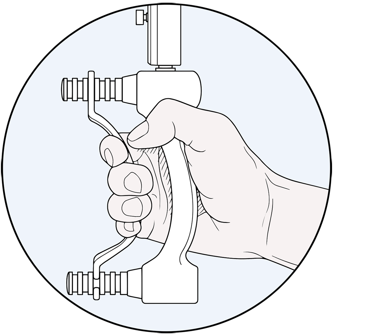 Clinical experience with the Ensemble CMC™ implant for treatment of osteoarthritis of the thumb